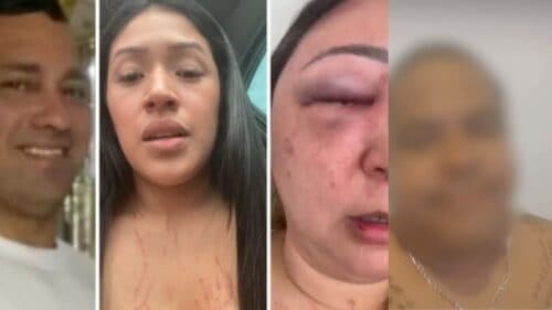 VÍDEO: “Pegou peia pra deixar de ser lesa”, diz advogado ao debochar de mulher agredida por assessor parlamentar