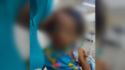 Veja como ficou cabeça de criança espancada pelo próprio pai, no AM
