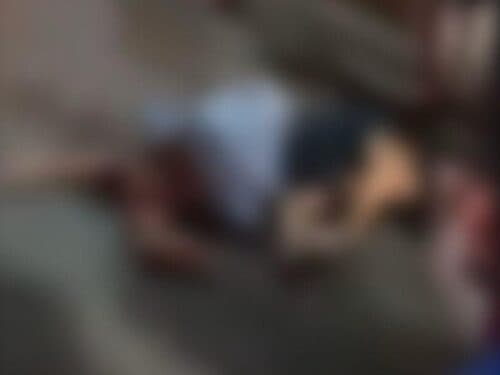 VÍDEO: Mulher é atropelada e ossos ficam expostos, no AM