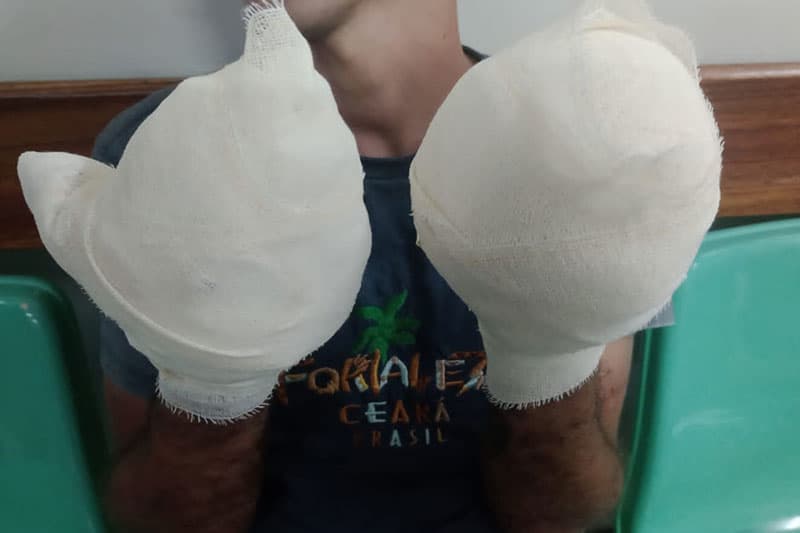 FOTO: Homem tem dedos arrancados em “tribunal do crime” no bairro Compensa
