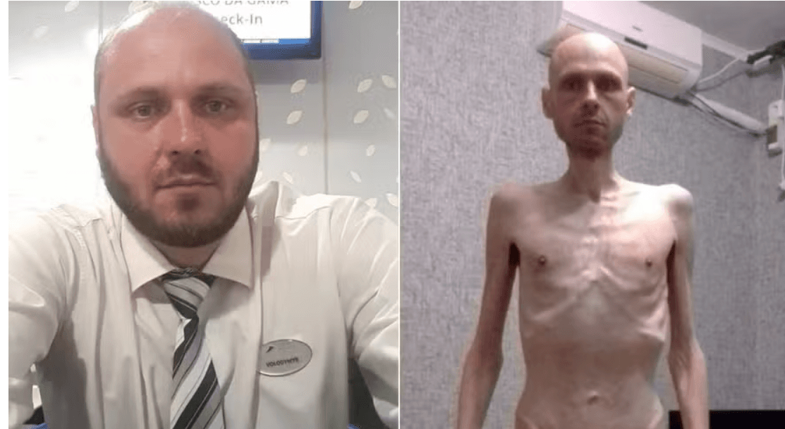 Antes e depois de militar feito de prisioneiro na Rússia impressiona