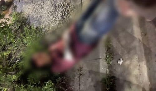 Homem é torturado a pauladas e tem perna perfurada durante suposto assalto, em Manaus