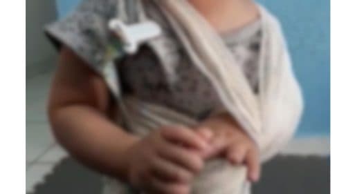 Pais são investigados por tortura de bebê de 1 ano que teve clavícula quebrada e pés queimados, em Manaus