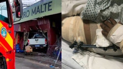 Funcionário de bar que teve as pernas quebradas em acidente se recupera após cirurgia
