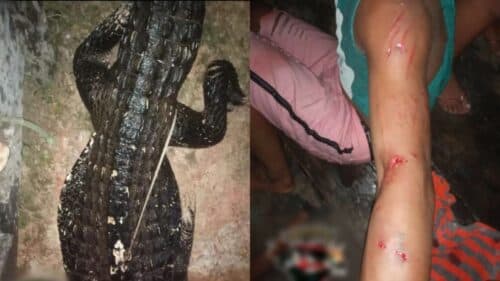 Em Manicoré-AM, homem tem braço mordido em ataque de jacaré; veja fotos