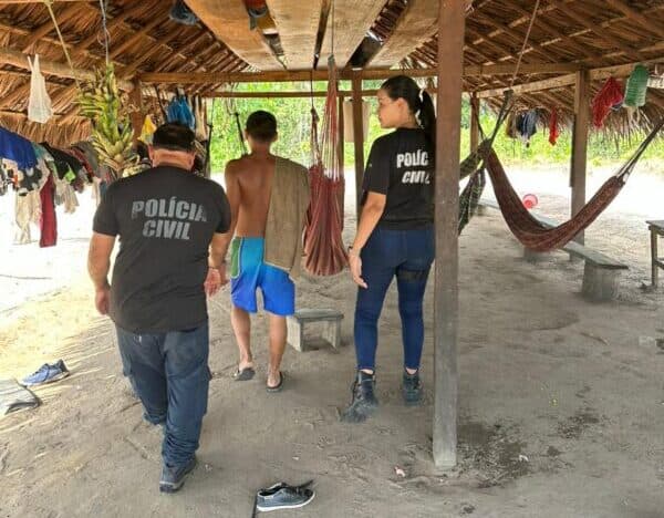 Bebê indígena de 9 meses tem o crânio exposto ao ser agredida por tio, no AM