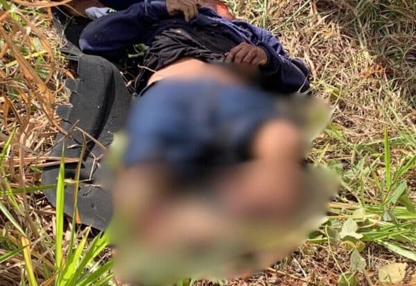 IMAGEM FORTE: Motociclista tem pé arrancado durante acidente na estrada de Manacapuru, no AM