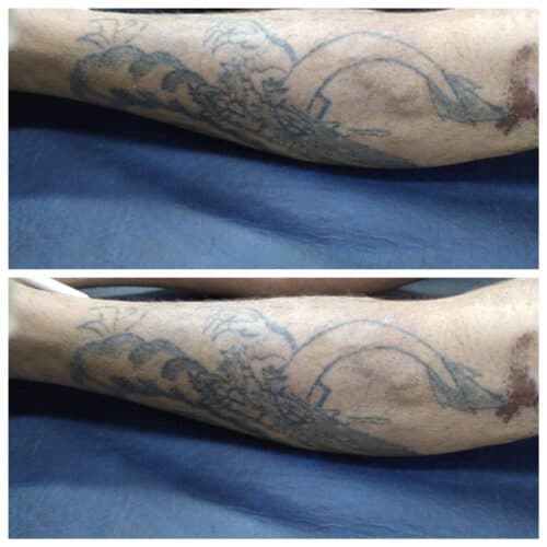 Hospital João Lúcio pede ajuda para encontrar familiares de paciente internado