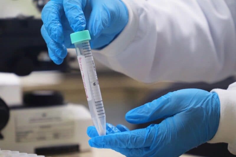 Casos de Mpox sobem para 11 no Amazonas