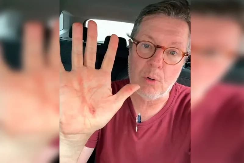 Âncora da CNN, Márcio Gomes se machuca após reagir assalto em São Paulo; Veja relato