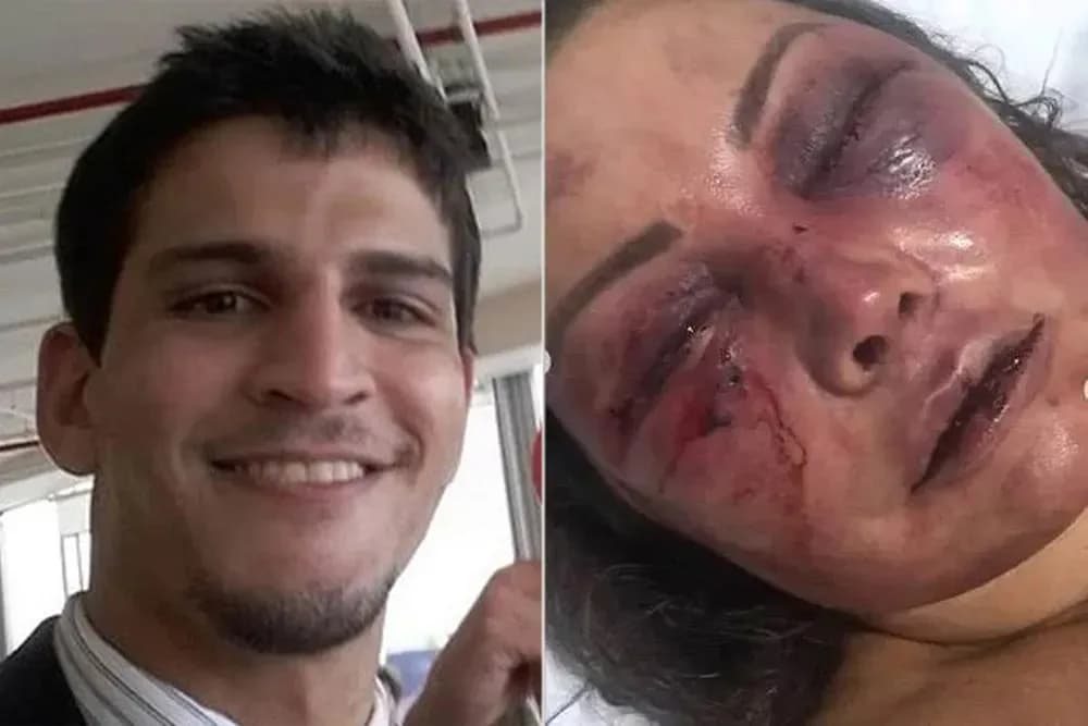 Homem que espancou mulher durante o sono é absolvido pela Justiça do RJ: Entenda o que é ‘parassonia’