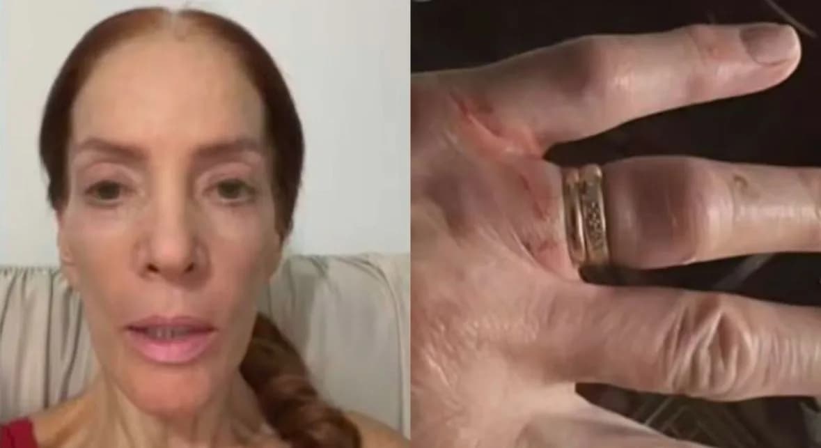 Suspeito de morder dedo de idosa para levar anel em tentativa de assalto é preso