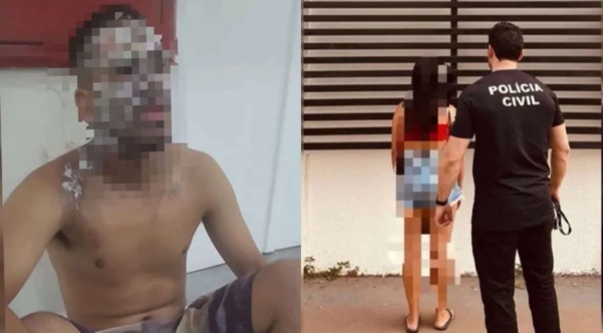 Após discussão, mulher joga água fervendo no rosto do marido, em GO