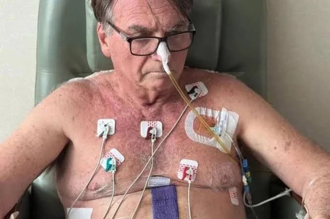 Bolsonaro está estáveI mas sem previsão de alta; leia novo boletim médico