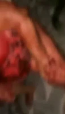 IMAGENS FORTES: idosa é atacada pelo filho com terçado e tem rosto desfigurado