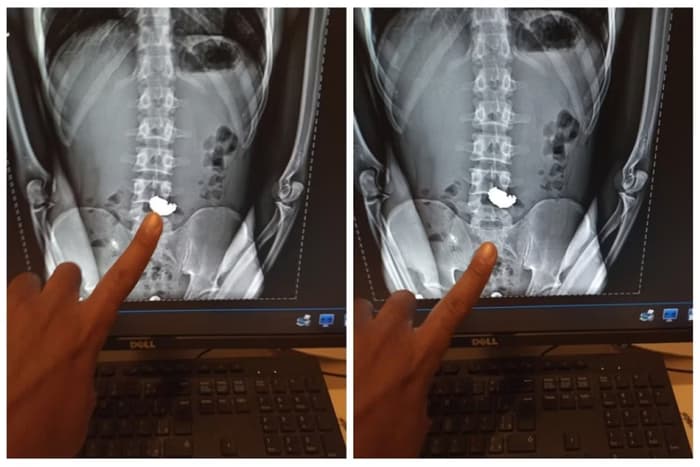 Assaltante engole corrente de ouro durante abordagem da polícia em Minas Gerais