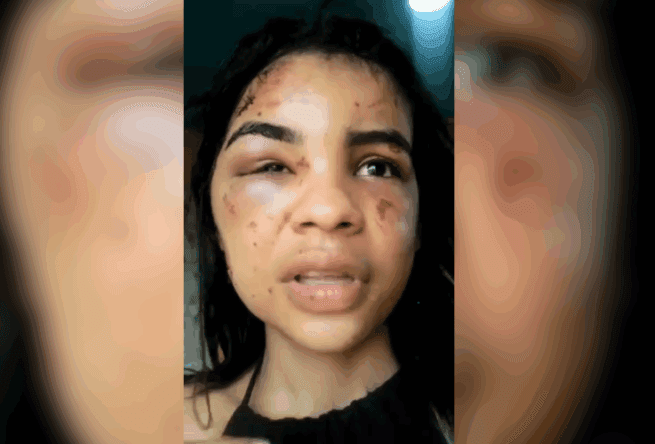 Mulher é brutalmente agredida por recusar relação com homem ao sair de adega em Manaus