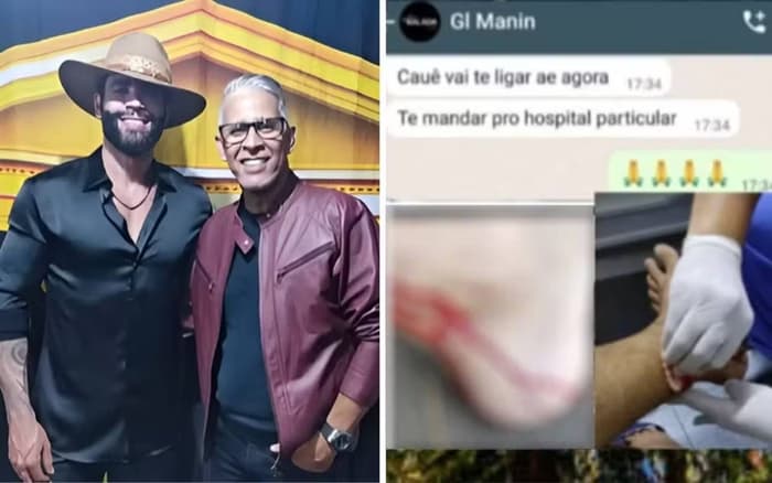Irmão de Gusttavo Lima é mordido por macaco durante passeio em Goiânia e cantor reage: “É azarado”