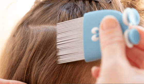 O que ninguém conta sobre piolhos; saiba mitos e verdades