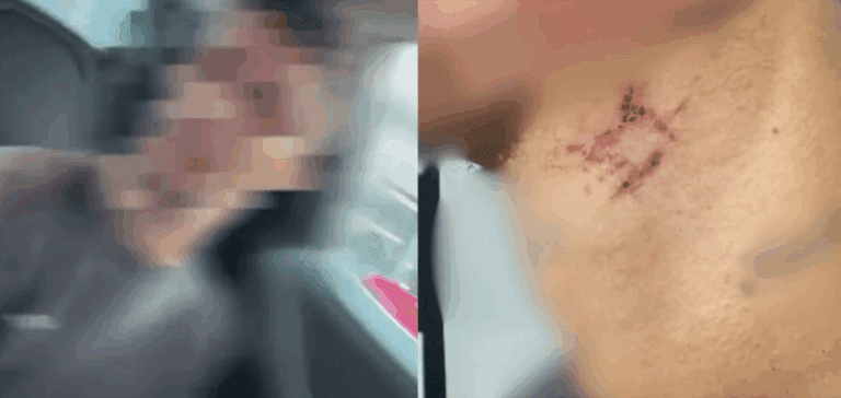 Vítima de 22 anos é resgatada após mais de um ano presa e abusada por traficante em Goiânia