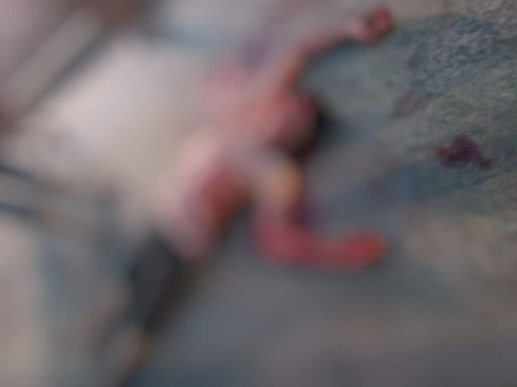 IMAGEM FORTE: Homem agoniza após ser esfaqueado por mulher em Manicoré