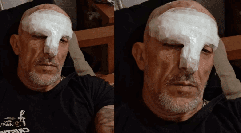 Cristian Cravinhos leva 15 pontos no rosto após acidente de moto em São Paulo