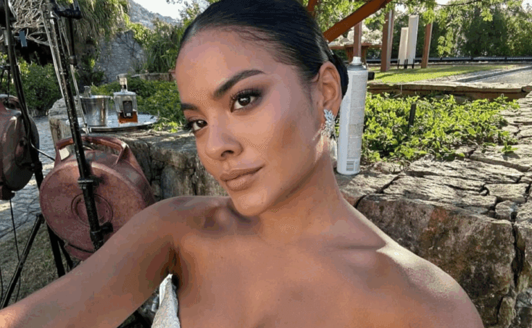 Atriz Bella Campos mostra como ficou mordida de jacaré na perna