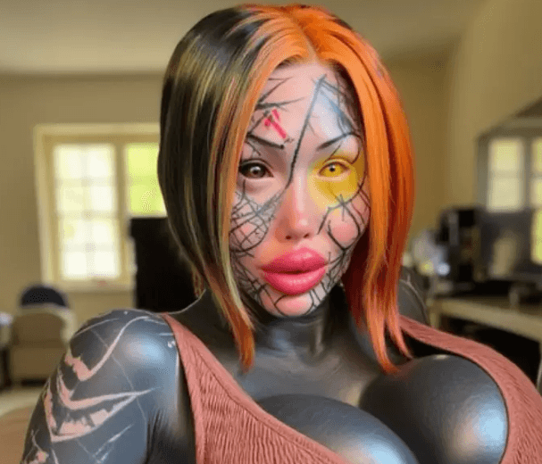 Modelo canadense revela foto antiga e impressiona seguidores após gastar cerca de R$ 2,7 milhões em cirurgias