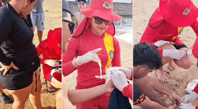 Novo ataque de piranhas deixa seis feridos em balneário de Manacapuru