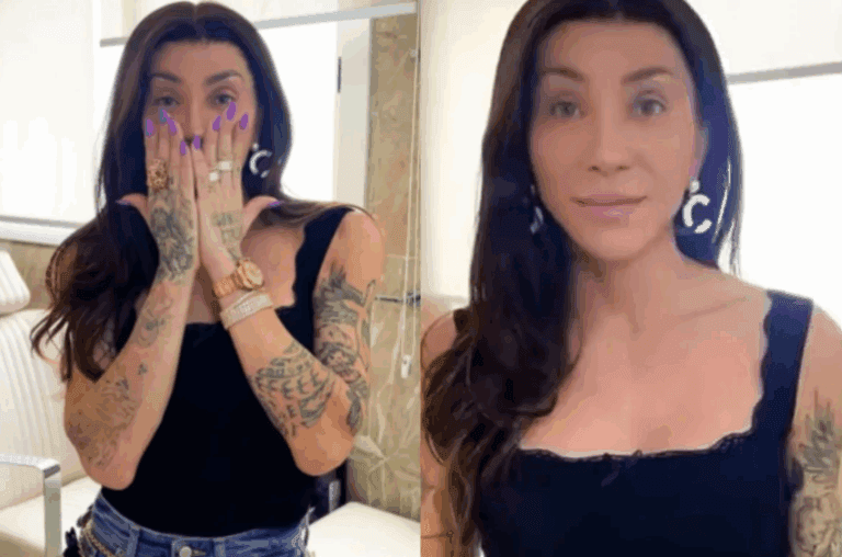 Maya Massafera mostra resultado de cirurgia no rosto: “Não se assustem”