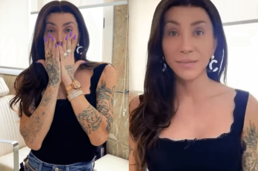 Maya Massafera mostra resultado de cirurgia no rosto: “Não se assustem”