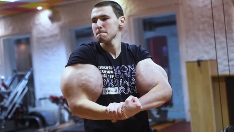Influenciador conhecido como “Popeye russo” corre risco de perder braços por injetar óleo nos bíceps