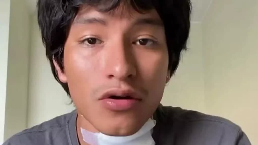 Cantor leva choque no palco durante show no Peru e sofre queimaduras