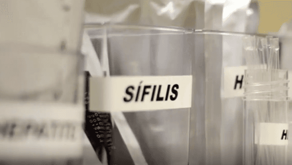 Sífilis segue em alta no Brasil e preocupa especialistas