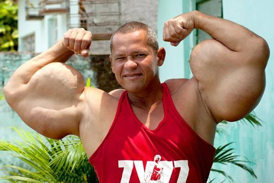 Morre Arlindo Anomalia, conhecido como Popeye brasileiro, aos 55 anos