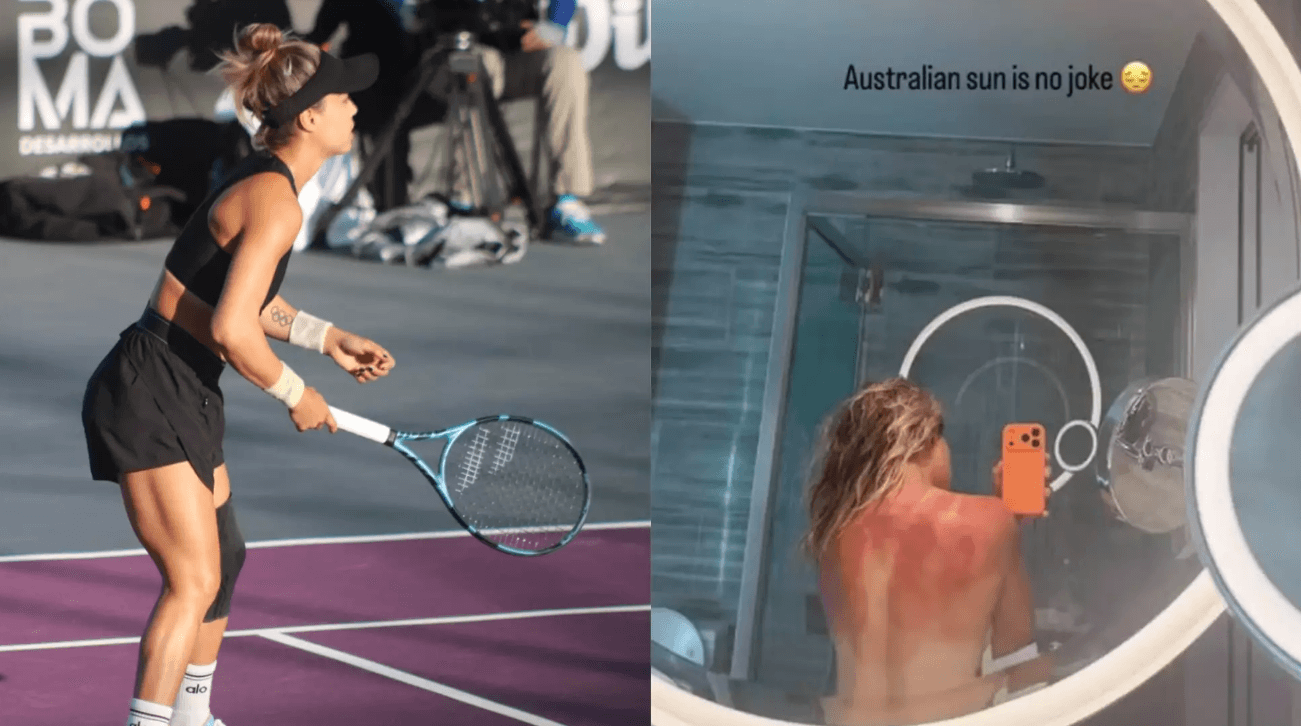 Tenista mexicana sofre queimaduras em jogo sob calor extremo na Austrália