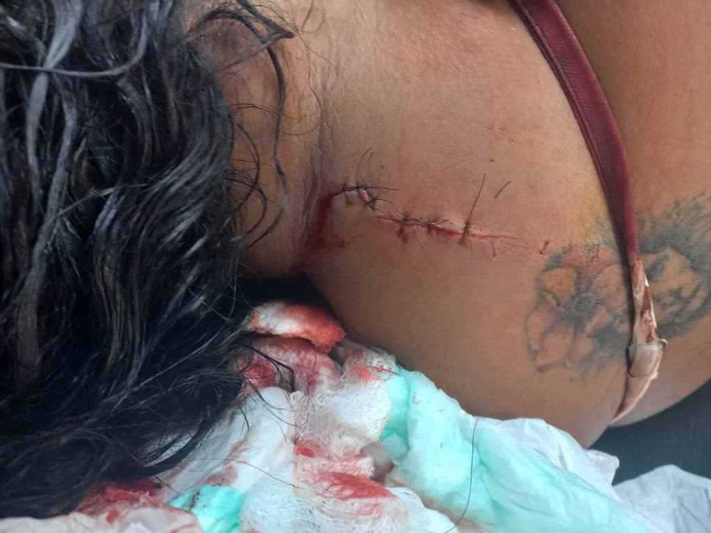 Homem é suspeito de tentar matar esposa com gargalo de garrafa em Manaus