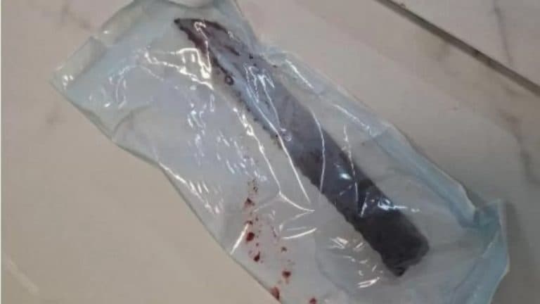 Mulher tem faca cravada no olho após tentativa de feminicídio em Santa Catarina