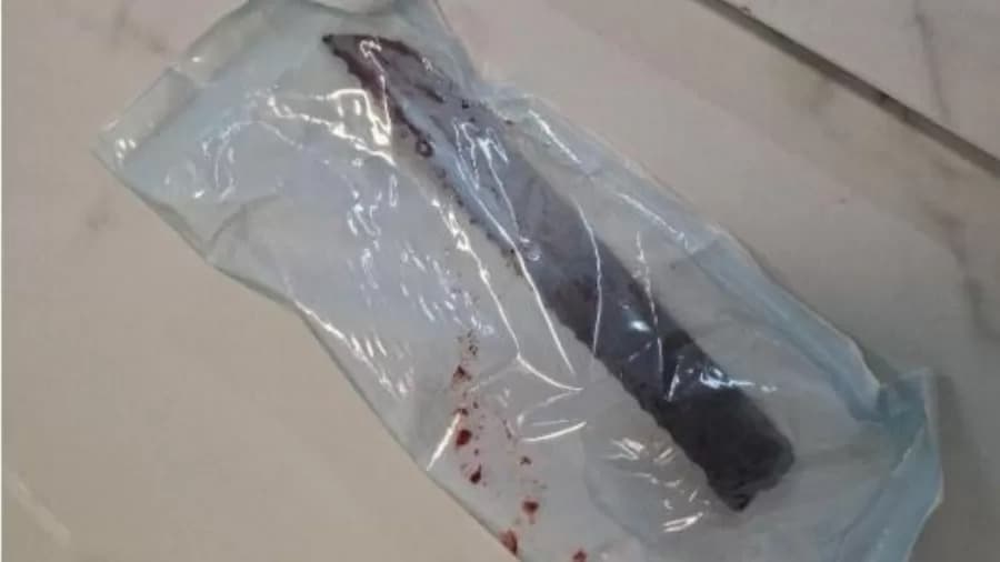 Mulher tem faca cravada no olho após tentativa de feminicídio em Santa Catarina