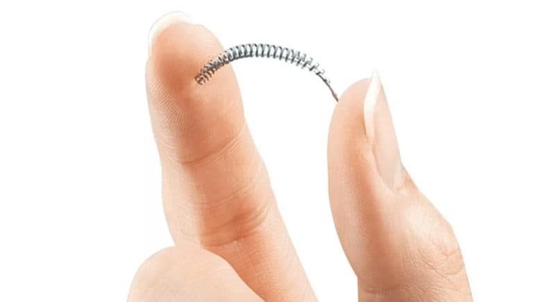 Vítimas do contraceptivo Essure cobram assistência e reparação