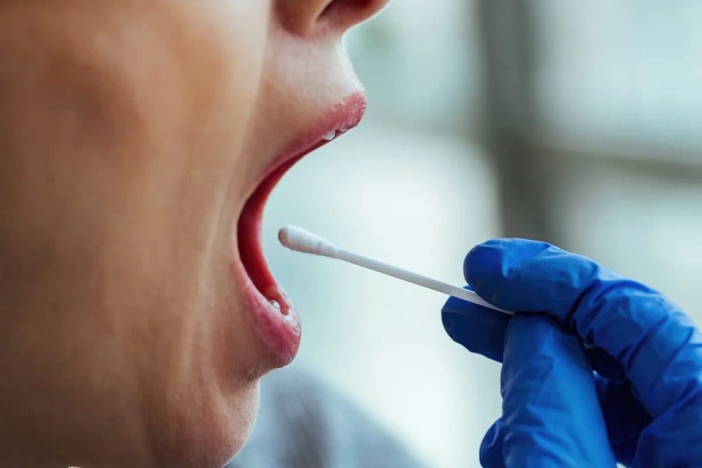 Análise de saliva pode identificar sinal de câncer colorretal, aponta estudo