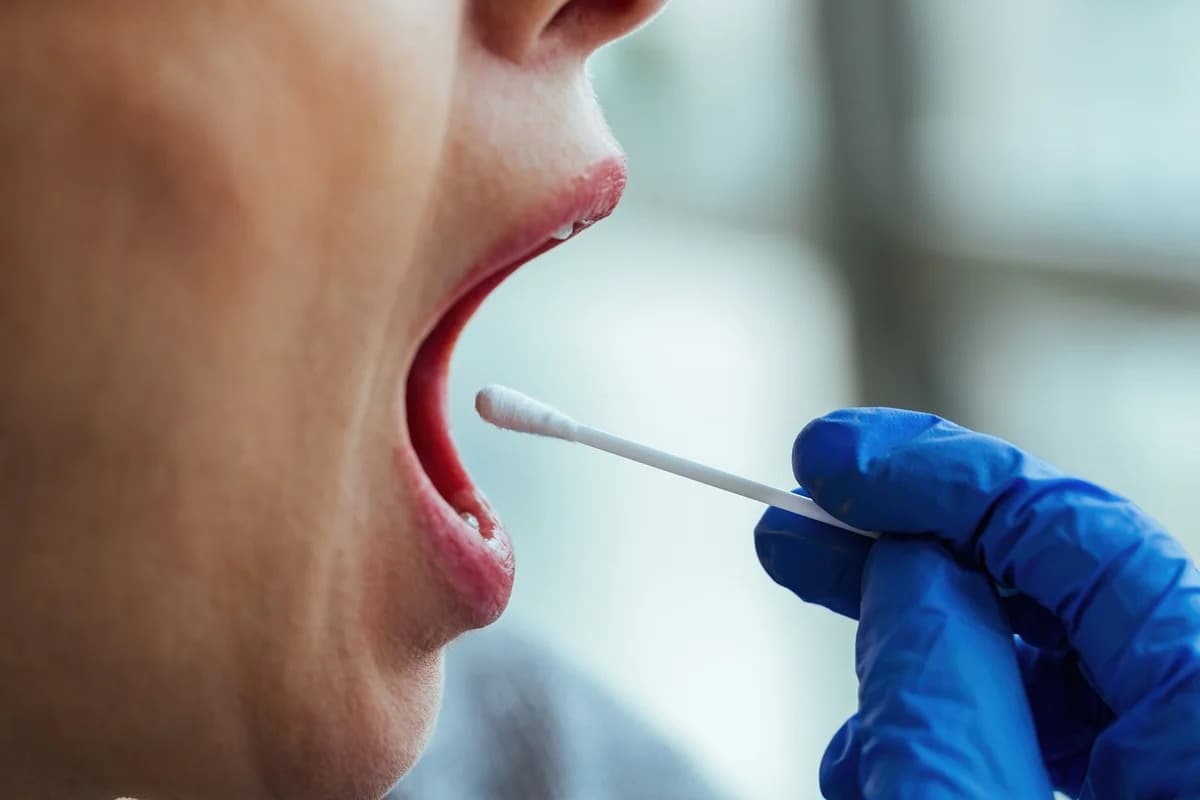 Análise de saliva pode identificar sinal de câncer colorretal, aponta estudo