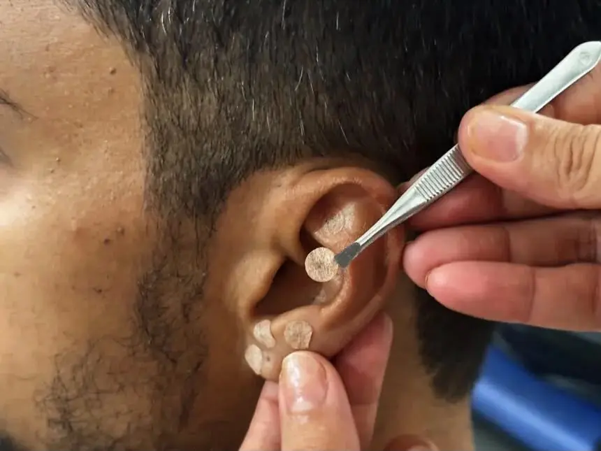 Quer parar de fumar? Palmas oferece tratamento gratuito com apoio profissional e auriculoterapia