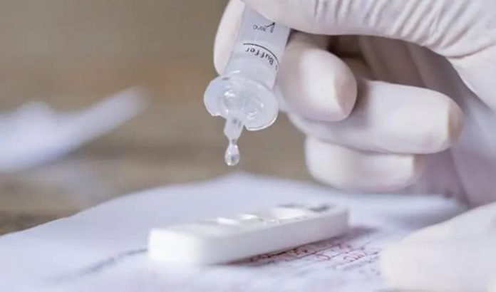 A diretoria da Agência Nacional de Vigilância Sanitária (Anvisa) adiou, nesta quarta-feira (19), a proposta de liberação de aplicação de testes rápidos de antígeno para covid-19, os chamados autotestes