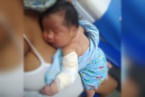 Bebê tem braço fraturado durante parto no Amazonas; saiba como ajudar a família (Foto: Reprodução)