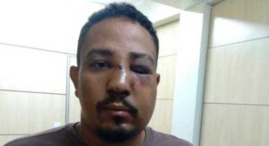 Cartomante que foi agredido por cliente (Foto: Divulgação)