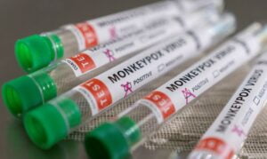 Ministério da Saúde confirma mais um caso de varíola de macacos