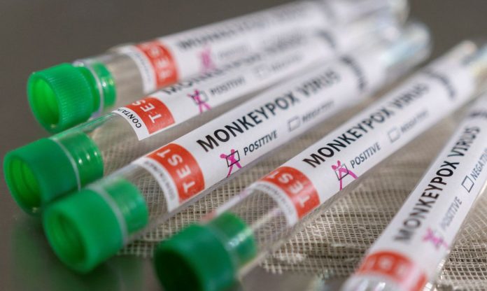 A Agência Nacional de Vigilância Sanitária (Anvisa) aprovou nesta terça-feira (20) o primeiro produto para o diagnóstico da monkeypox no Brasil