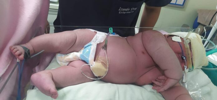 Bebezão: campanha arrecada fraldas para bebê que nasceu com mais 7kg em Parintins