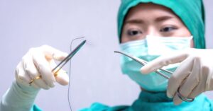 Mulher descobre agulha e linha dentro do corpo, 11 anos após cirurgia